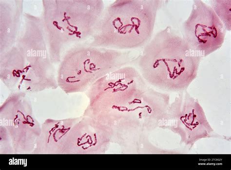 Giant Or Polytene Chromosomes Of Chironomus Salivary Glands Optical