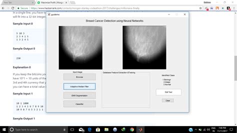 Detection Of Breast Cancer Using Neural Networksreadmemd At Master