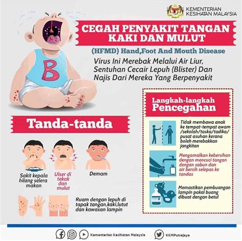 Hfmd Punca Simptom Rawatan And Risiko Jangkitan Di Malaysia