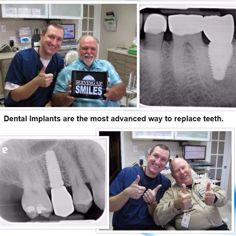 Bone Loss Dental Implants Pasadena Deer Park Tx