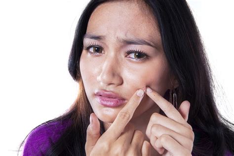 What Your Acne Is Trying To Tell You About Your Health