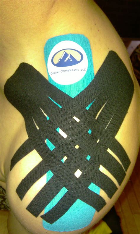 kinesio tape for shoulder pain | Kinesio taping, Kinesiology taping, Tape