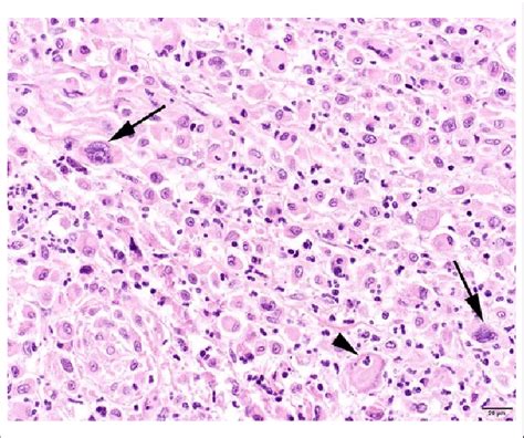 Histiocyte Histology