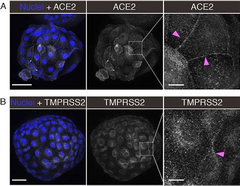 Localization Of Ace2 And Tmprss2 In Embryos Maximum Intensity Download Scientific Diagram