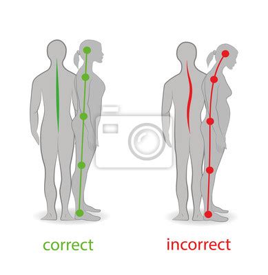 Postura correta e incorreta vista lateral e traseira recomendações