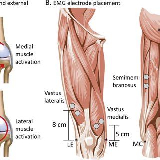 A Internal And External Knee Joint Moments Direction Of Internal