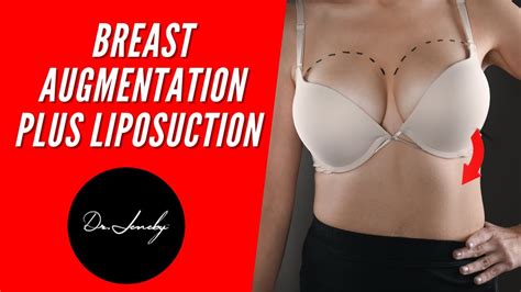 Dr Jeneby Plastic Surgery Breast Augmentation Plus Liposuction Youtube