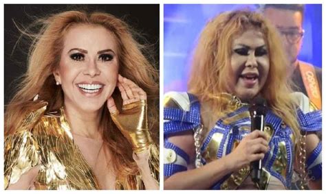 O Que Realmente A Causa Do Rosto Inchado Da Cantora Joelma Portal