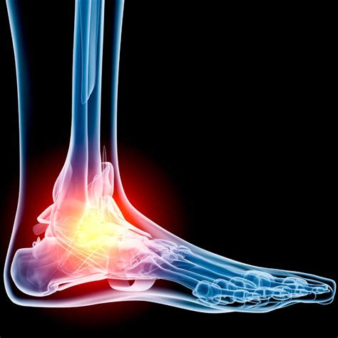 Types of Ankle Surgery - Detroit Anesthesia Services