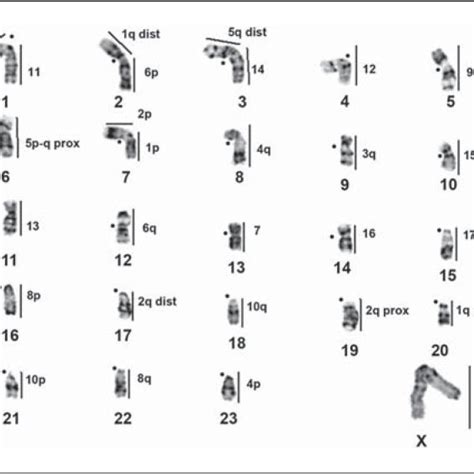 G Banded Haploid Karyotype Of A Male D Auricularis With Regions Of