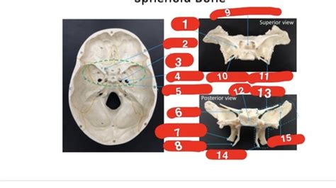 Sphenoid And Ethmoid Bones Flashcards Quizlet