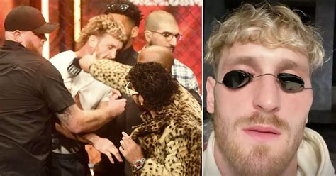 Logan Paul Shows Off Swollen Face After Being Cut By Dillon Danis