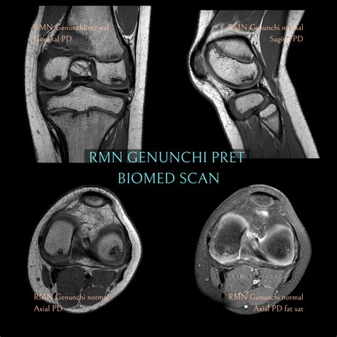 Rmn Genunchi Pret Lei Biomed Scan