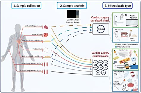 Microplastics Found In Human Heart Tissues Both Before And After