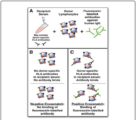 Flow Cytometry Crossmatch A Serum From The Recipient Is Added To