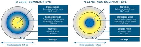 What Are Multifocal Contact Lenses And Should You Order Them Online Contacts Advice