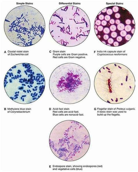 Tinciones Para Bacterias Medical Laboratory Science Microbiology Medical Laboratory