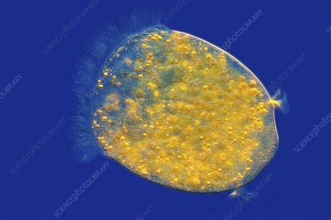 Vorticella Protozoan Light Micrograph Stock Image C015 3386