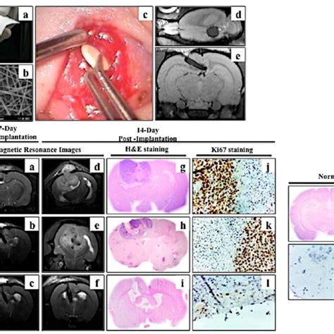 (PDF) The Evolving Neural Tissue Engineering Landscape of India