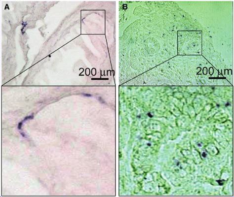 Chromogenic In Situ Hybridization For Alu Sequences To Detect Human