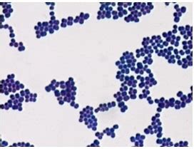 Bacterial Smears Staining Flashcards Quizlet