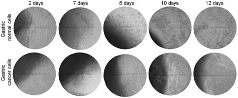 A Method For Establishing Human Primary Gastric Epithelial Cell Culture