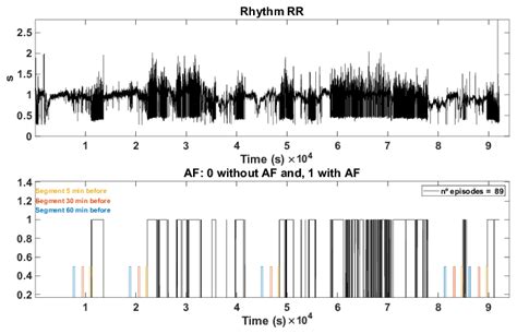 Rr Interval Series In A Recording From The Dataset Top And The