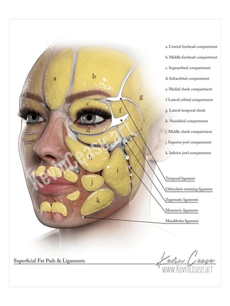 Facial Liposuction (Perioral)