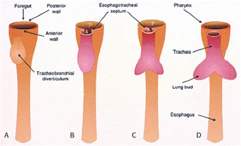 The Nonneoplastic Esophagus Abdominal Key