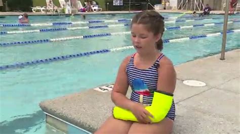 Technology advancements lead to creation of waterproof casts - ABC13 ...