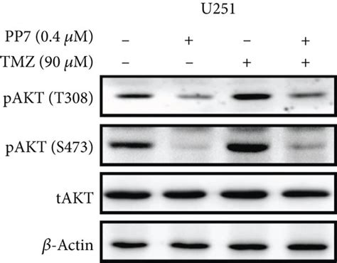 Pp7 Reduces Tmz Resistance In U251 And U87 Mg Cells By Suppressing The