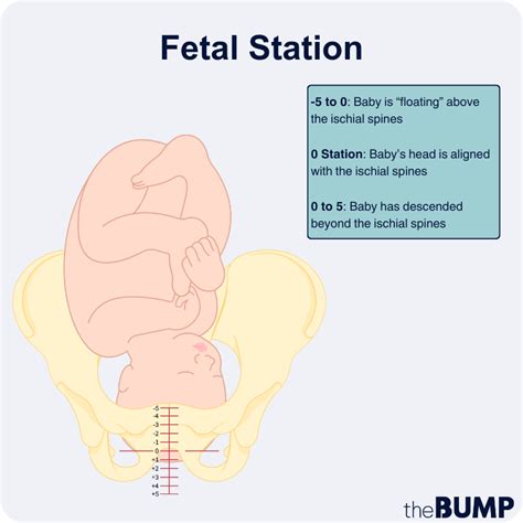 Fetal Station Definition Chart And More