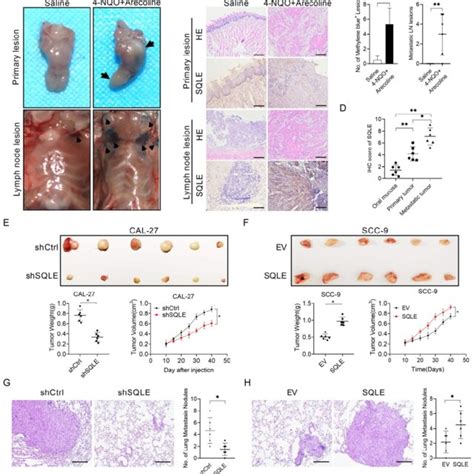 Sqle Upregulation Promoted Hnscc Cells Proliferation And Metastasis In