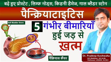 Pancreas Cancer Head Mass Tumor Pancreatitis Treatment In Hindi