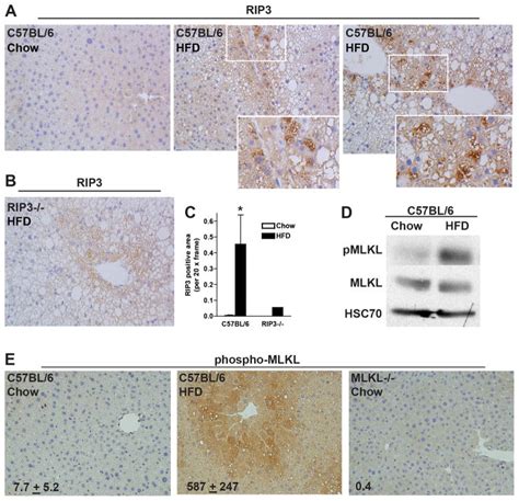 Receptor Interacting Protein 3 Protects Mice From High Fat Diet Induced