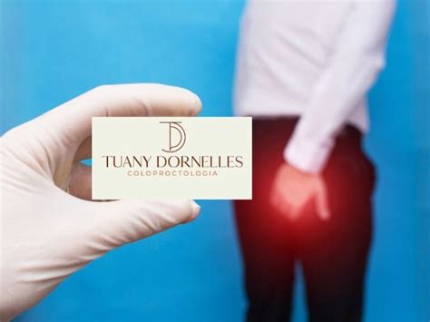 Reconstrução do Esfíncter Anal Sphincteroplasty Tuany Dornelles Coloproctologia