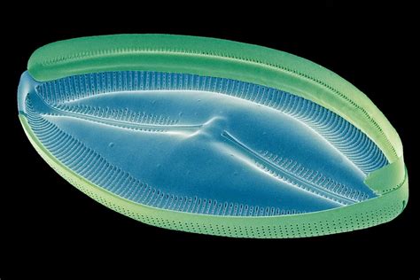 Examples Of Protists For Kids