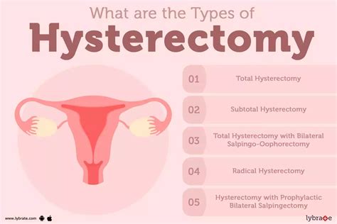 Hysterectomy