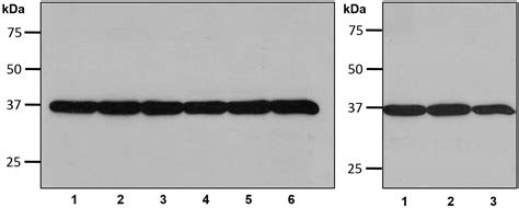 Anti-GAPDH - Antibodies - Products