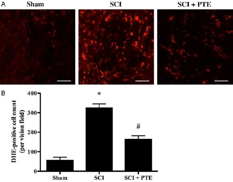 Figure From Pterostilbene Protects Against Traumatic Spinal Cord