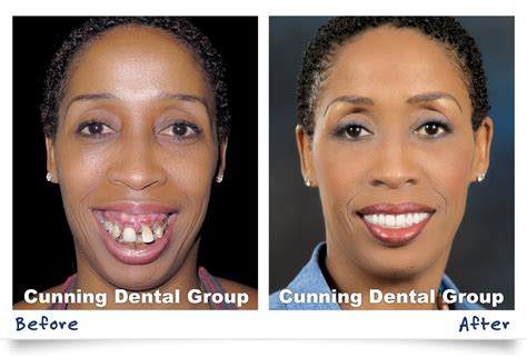 Cunning Dental Group Smile Gallery