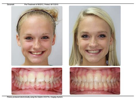 Best Orthodontist Near Me For Braces Lakenya Lofton