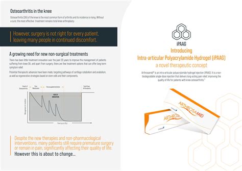 Arthrosamid Injections Essex - Knee Arthritis Injections - Leigh