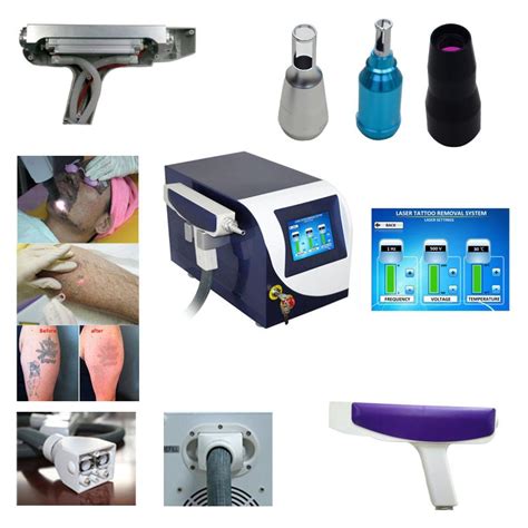 YAG Laser hair removal system | IPL Machines | Noble