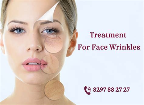 Treatment For Face Wrinkles | Anti Ageing - Layers clinics