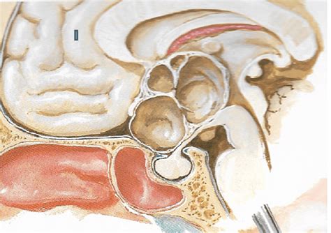 Il Percorso Diagnostico Integrato In Neuropsicologia Clinica RM