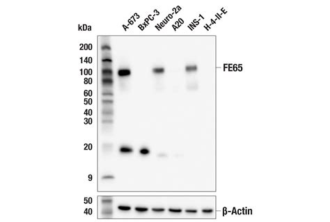 Fe E Y C Rabbit Mab Cell Signaling Technology