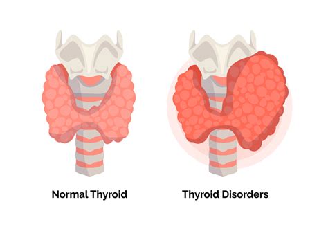 Endocrinology Services | Top Endocrinologists | Treatians