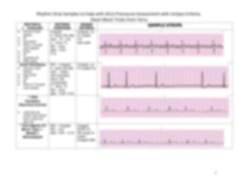 Solution Rhythm Strip Samples To Help With Acls Precourse Assessment With Unique Criteria Pdf