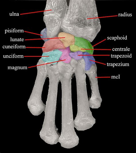 Carpal Bones Lesson Carpus Metacarpus And Digits Off